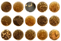 Bacteria isolated from human belly buttons and cultivated on plates in the laboratory. (Photos: Rob Dunn lab)