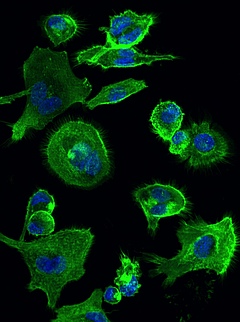 Auf der Oberfläche dieser Immunzellen befindet sich der betreffende Rezeptor namens HCA3. In der Abbildung sind Kern und Cytoskelett gefärbt (Bild: Claudia Stäubert).